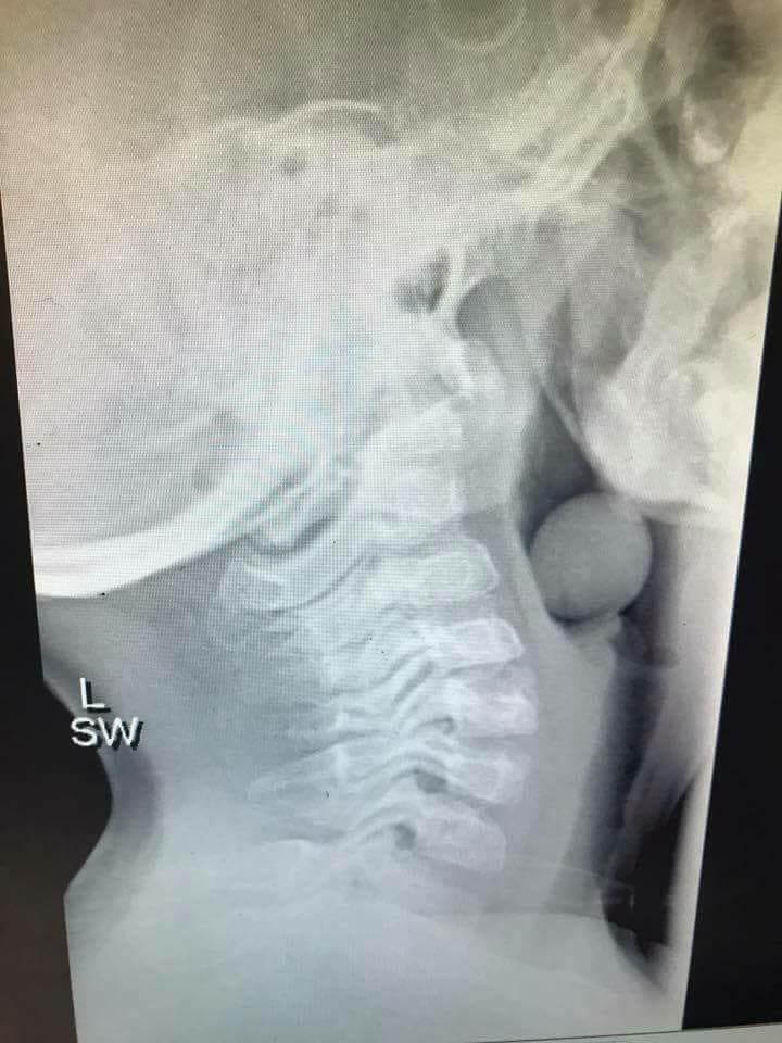 Best of X ray deep throat image Porn Clip Girl strip naked video