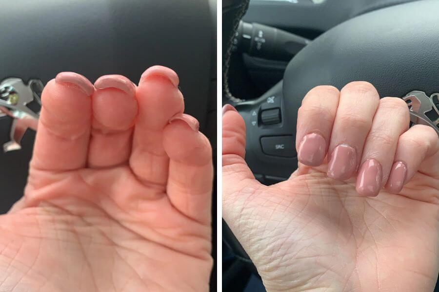 Poorly done nail art seen from two differente angles.