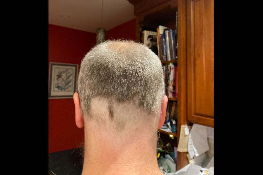 Back of the head of a middle age man with an uneven shaved head.