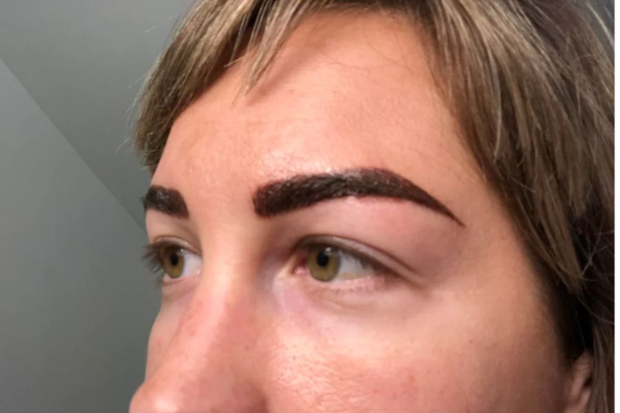 Close up of an uneven microblading job on a woman's face