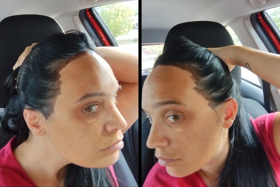 Two pictures of a middle age woman with brown hair dye on her forehead