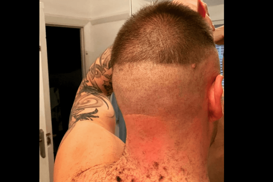 A DIY haircut gone wrong leaves him with an unintended "hairline horizon," creating a stark, unblended line across the back of his head.