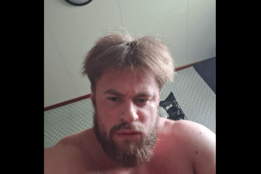 A bearded man with a serious expression shows off his DIY haircut, with messy, voluminous hair that creates a slightly disheveled and wild look.