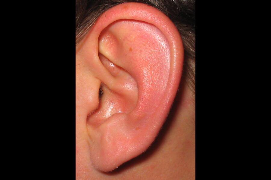 human ear