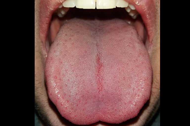 human tongue