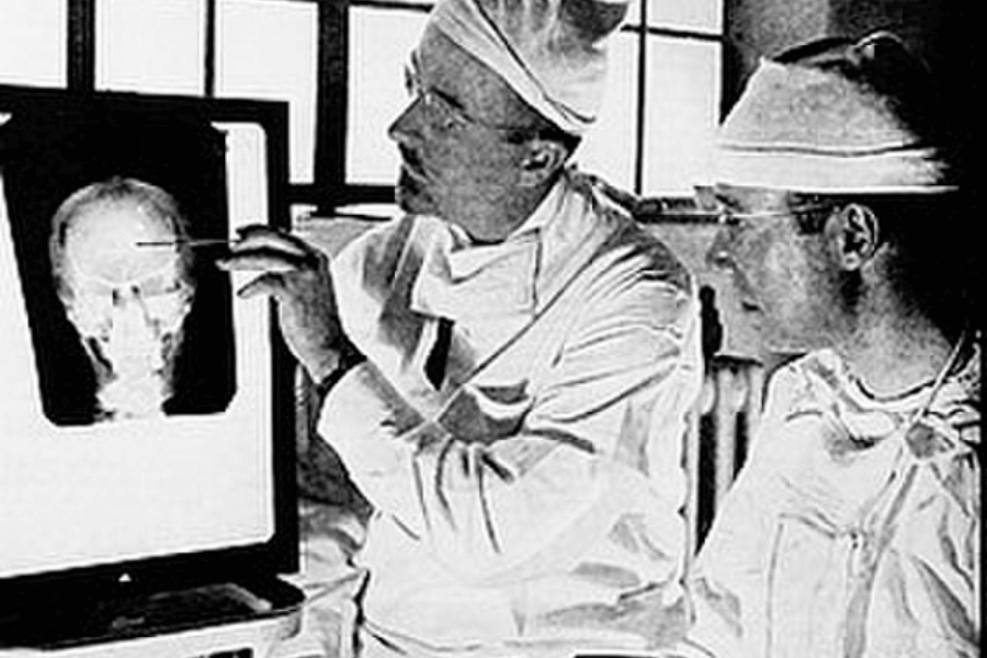 A black-and-white photograph showing two surgeons or medical professionals examining a skull X-ray displayed on a lightbox. One of the men is pointing to a specific area on the X-ray with a tool, while the other observes attentively. Both are dressed in surgical scrubs and caps, in a clinical setting with large windows in the background.