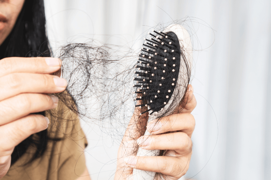 A close-up of a person holding a hairbrush with a large amount of hair tangled in its bristles. The other hand holds clumps of loose hair, indicating significant hair loss. 