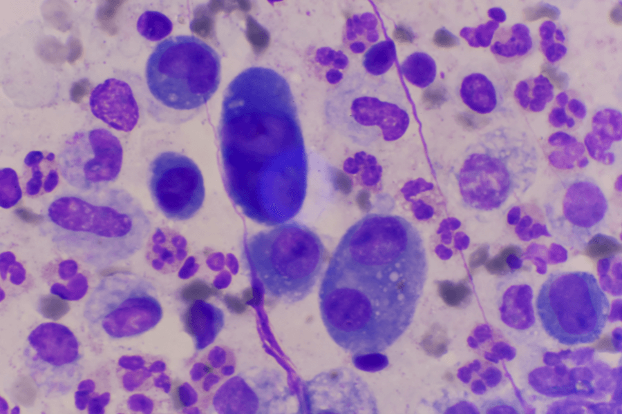 A microscopic view of stained biological cells in shades of purple and blue, highlighting different cell structures. Some larger, darker blue cells stand out among the smaller, clustered ones.