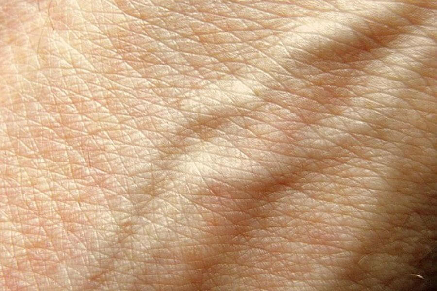 skins blood vessels