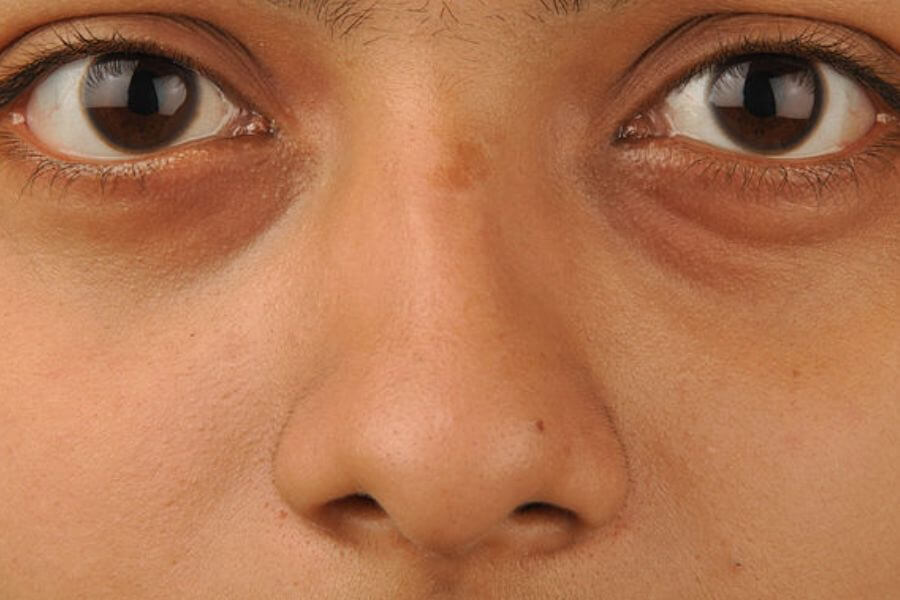 Eyes & Nose of a young woman in her thirthies