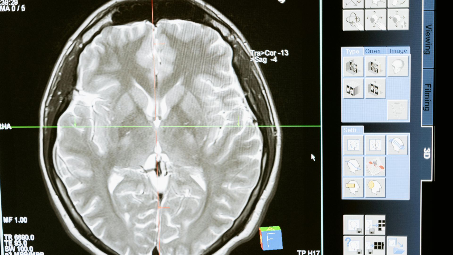 Digital illustration of a human head with technological elements symbolizing brain health research