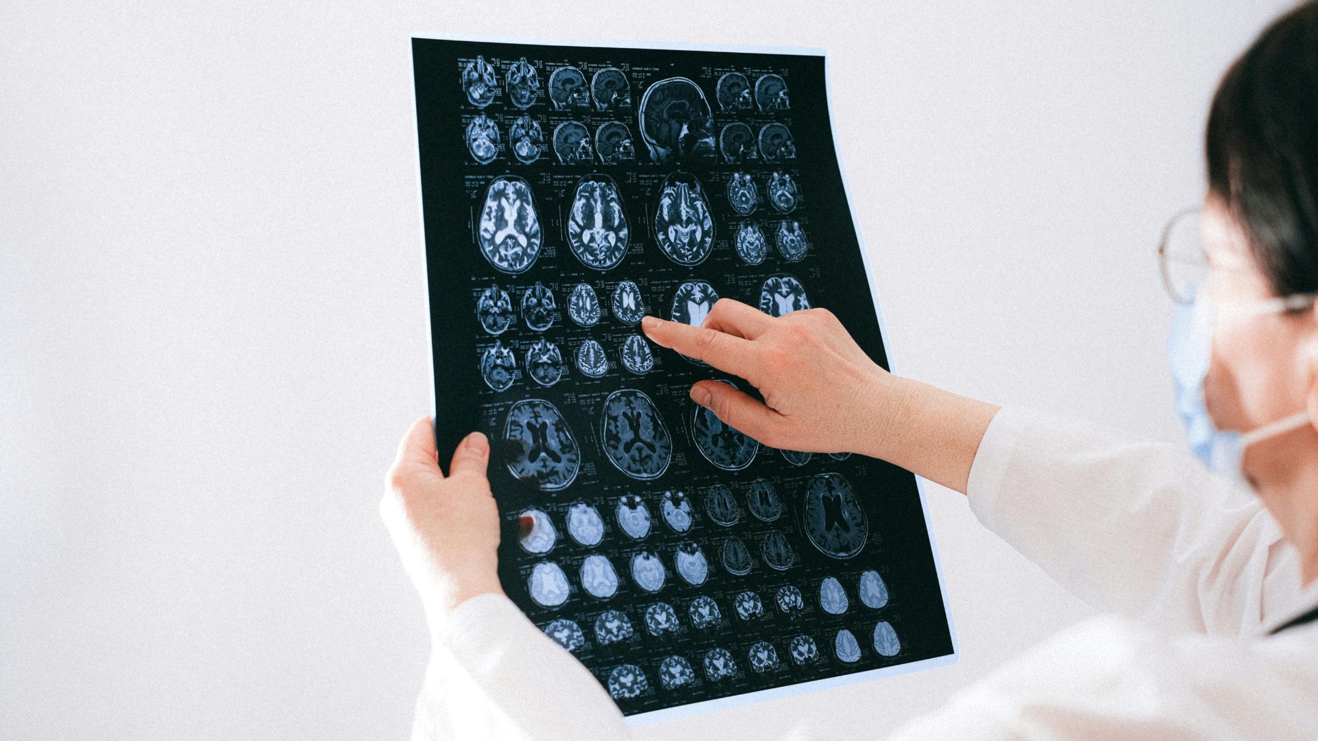 Doctor pointing at MRI brain scan on display