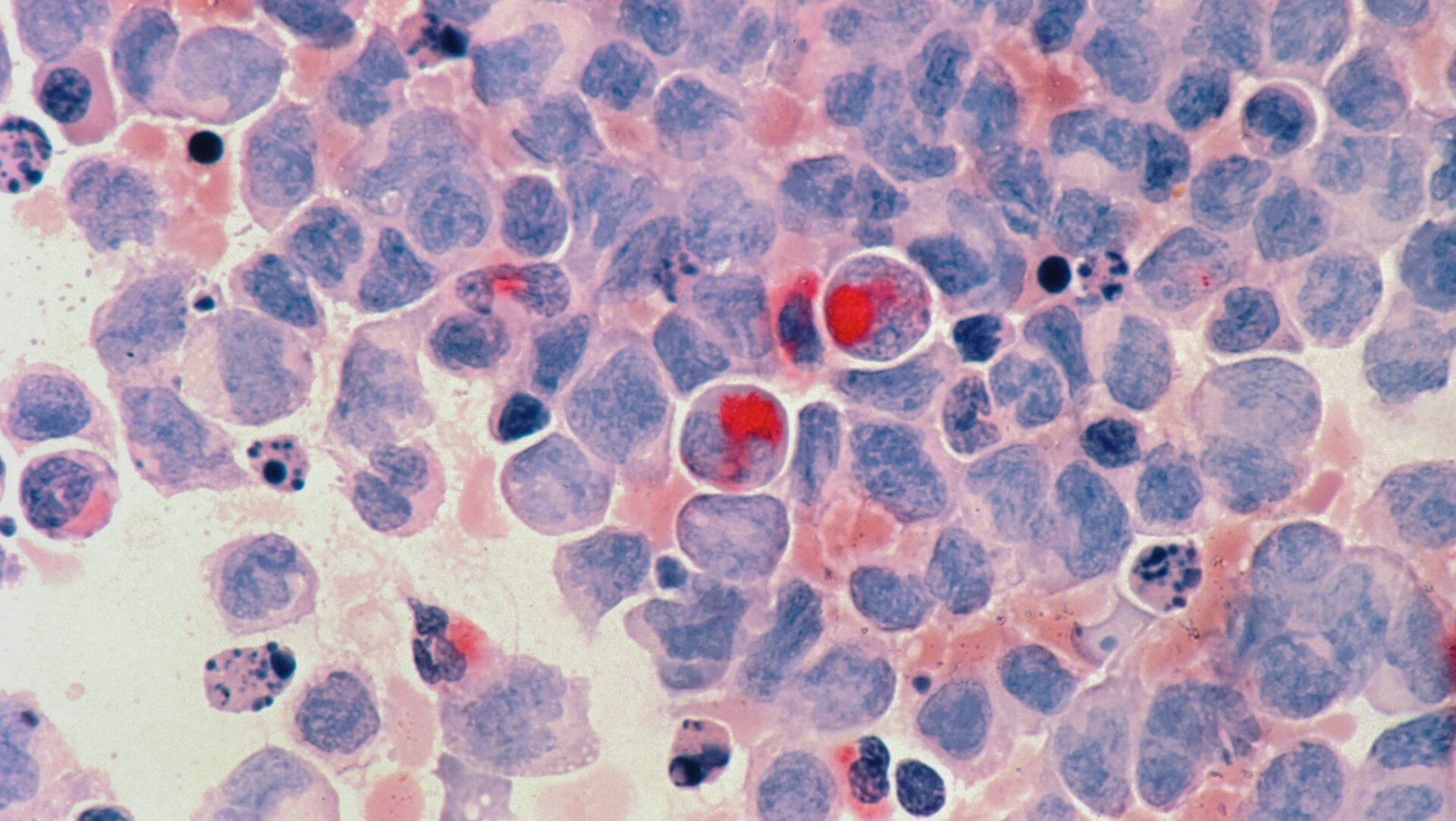 Close-up of a cancer cell.