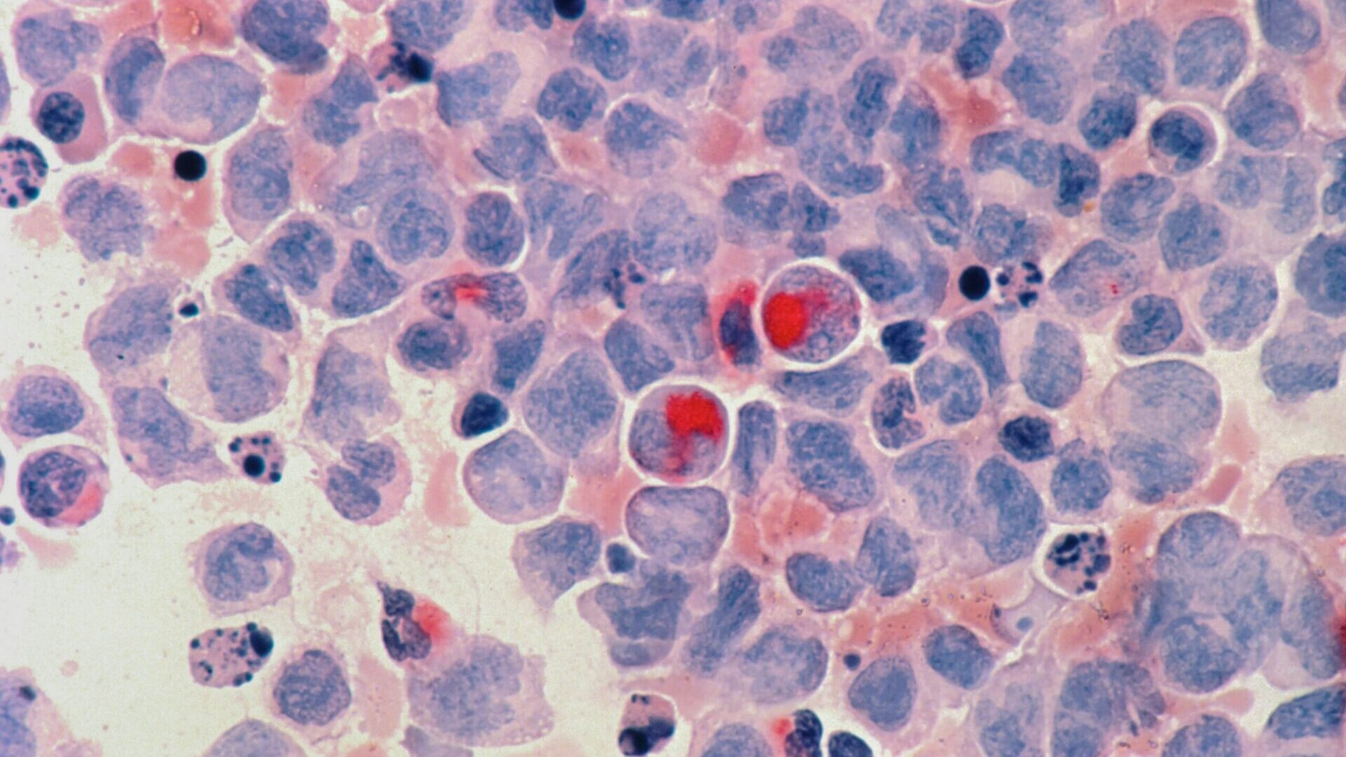Red round fruits arranged on a white and blue surface.