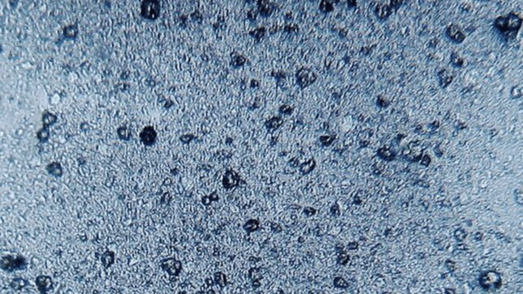 Microplastics detected in microscope.