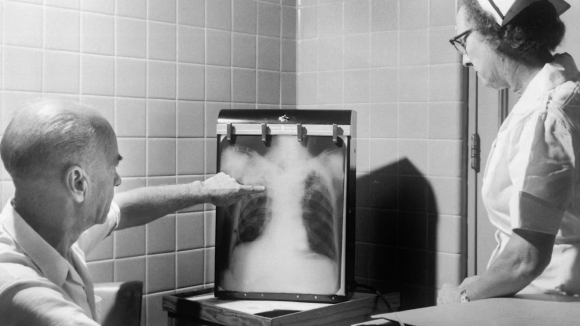 An image said to be taken in 1958, with a physician and nurse examining a tuberculosis positive chest x-ray