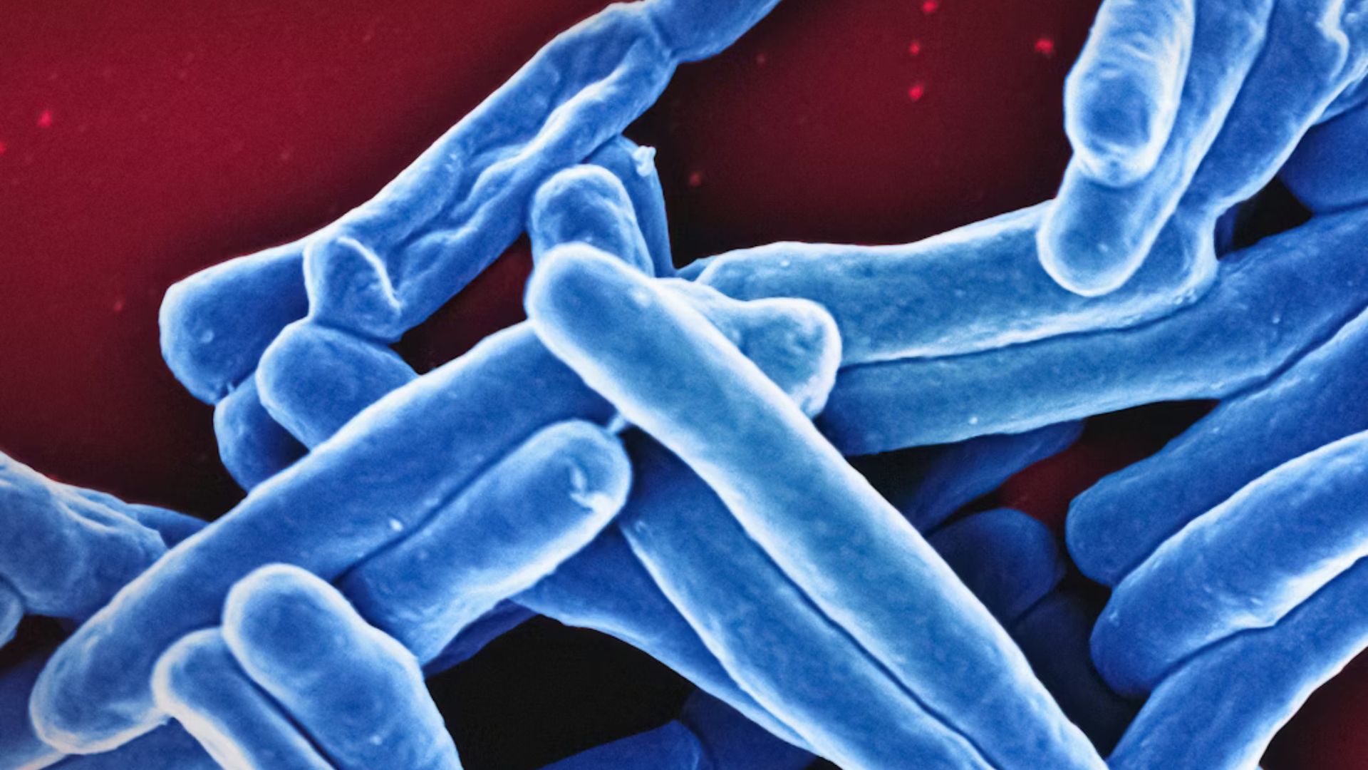 Electron micrograph of Mycobacterium Tuberculosis particles (colorized blue), the bacterium which causes TB