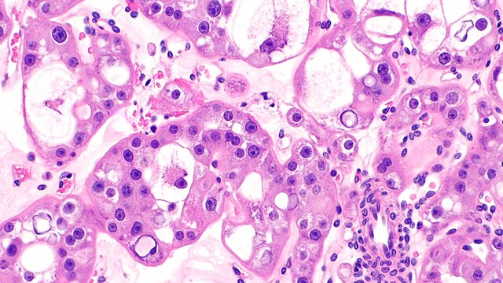 Kidney cells