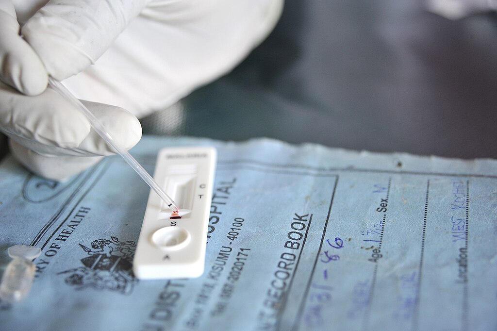 Malaria Rapid Diagnostic Test (RDT) being used at the Rabuor Health Center in Kenya