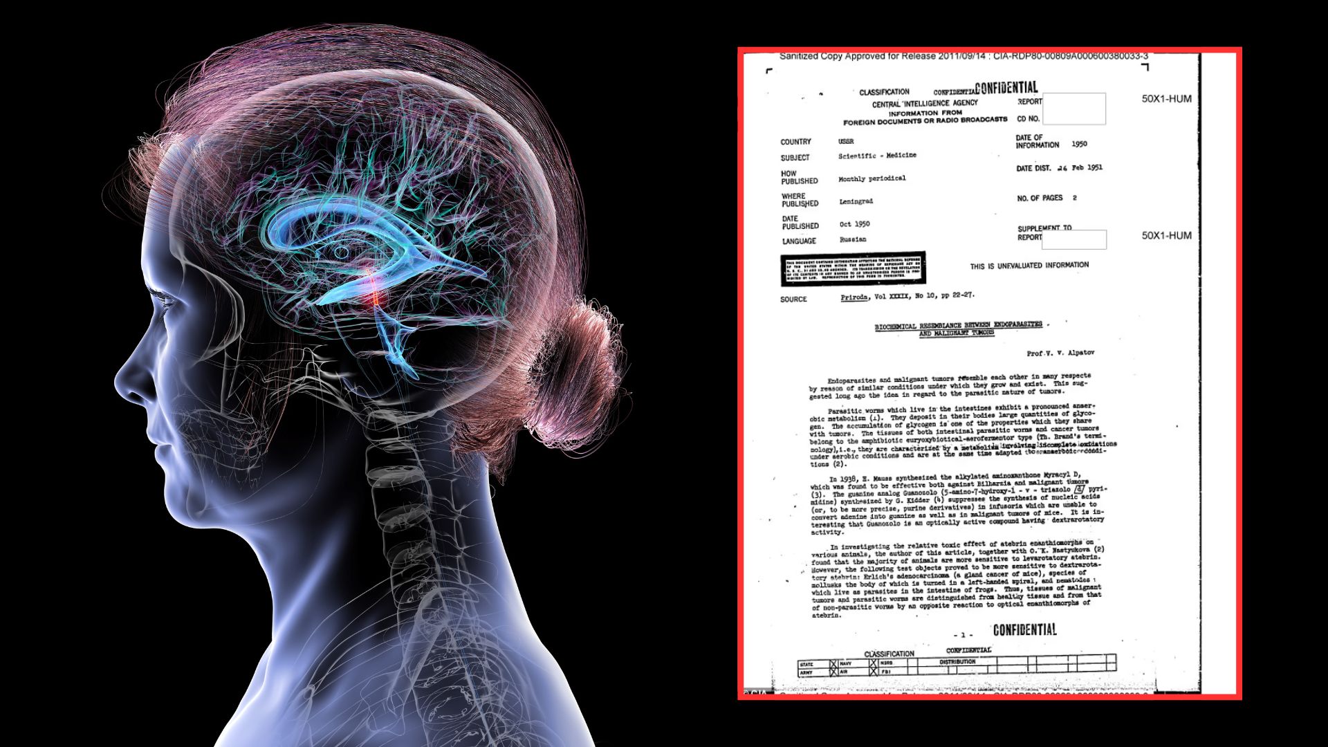 Illustration of a woman's head with a highlighted brain beside a declassified CIA document about tumors.