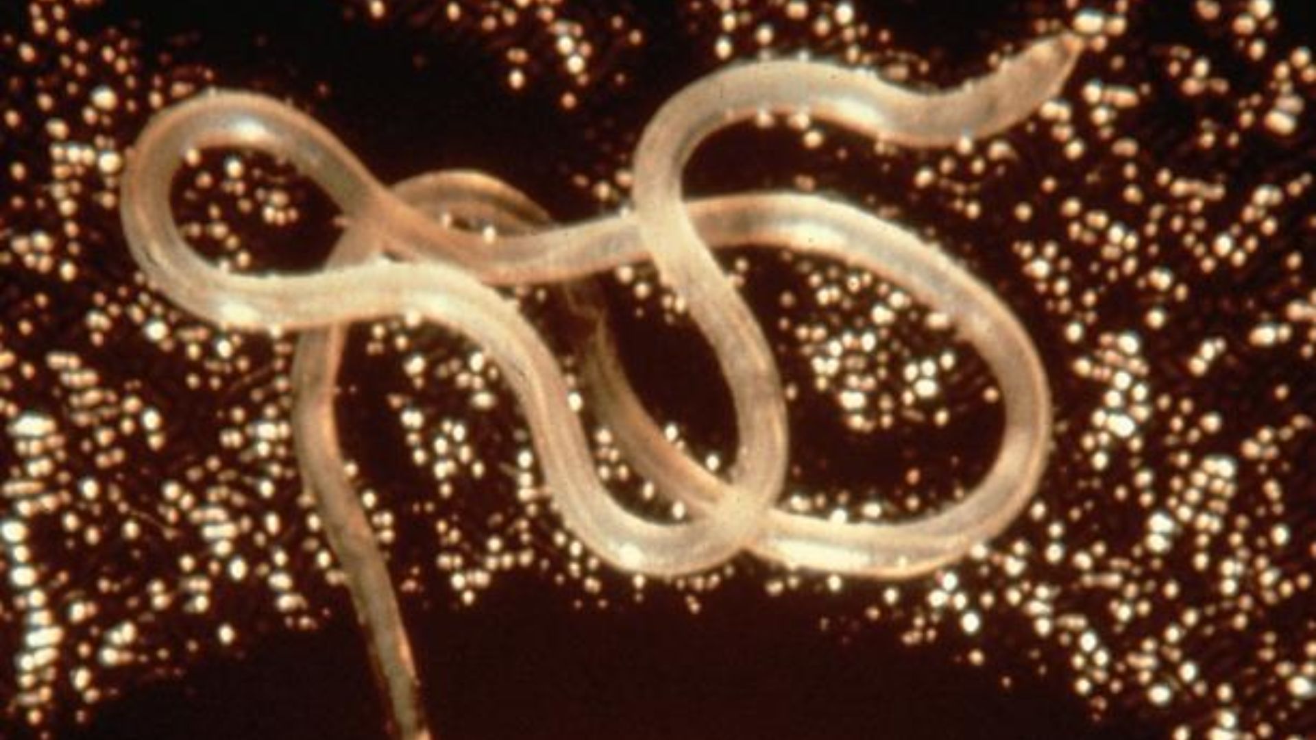Microscopic image of a parasitic worm against a dark background with bright specks.