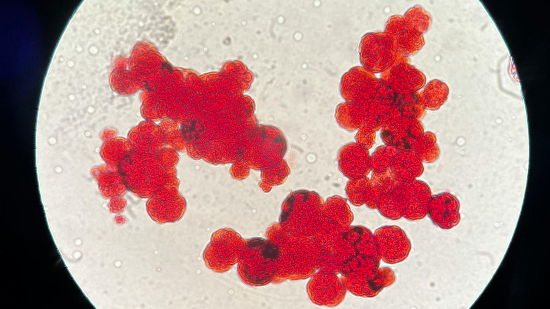 A microscopic view displays clusters of bright red, rounded cells against a pale, circular background.