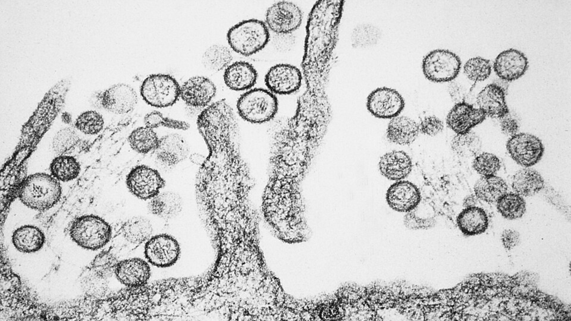 A high-magnification black-and-white transmission electron micrograph of hantavirus particles inside a host cell.