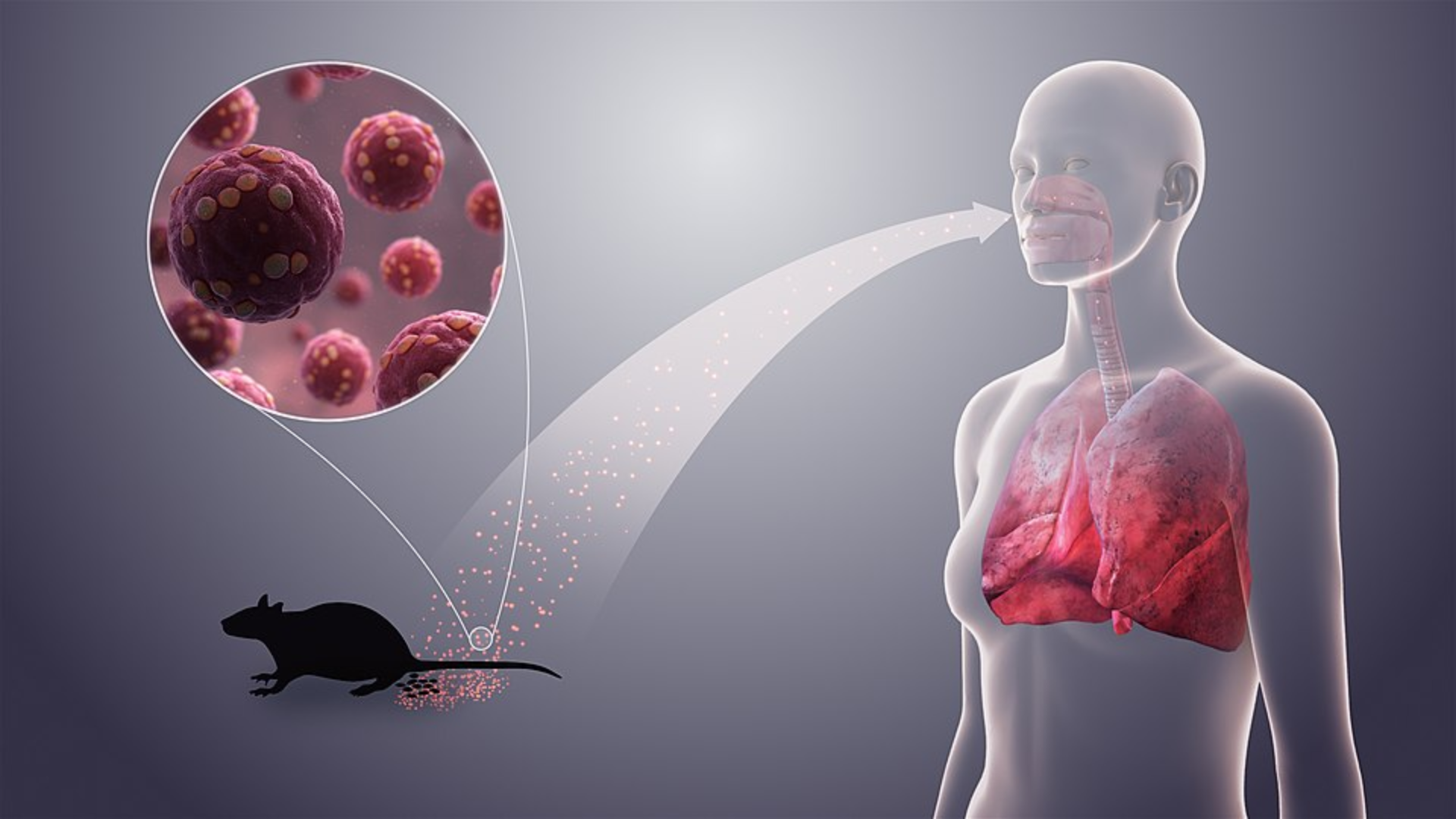 A medical diagram illustrating the transmission of hantavirus from rodent droppings through the air and into a person's lungs.