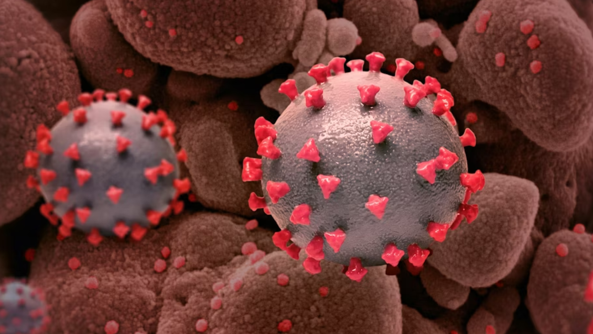 A colored electron micrograph showing multiple spherical hantavirus particles with red spike-like proteins on their surface.