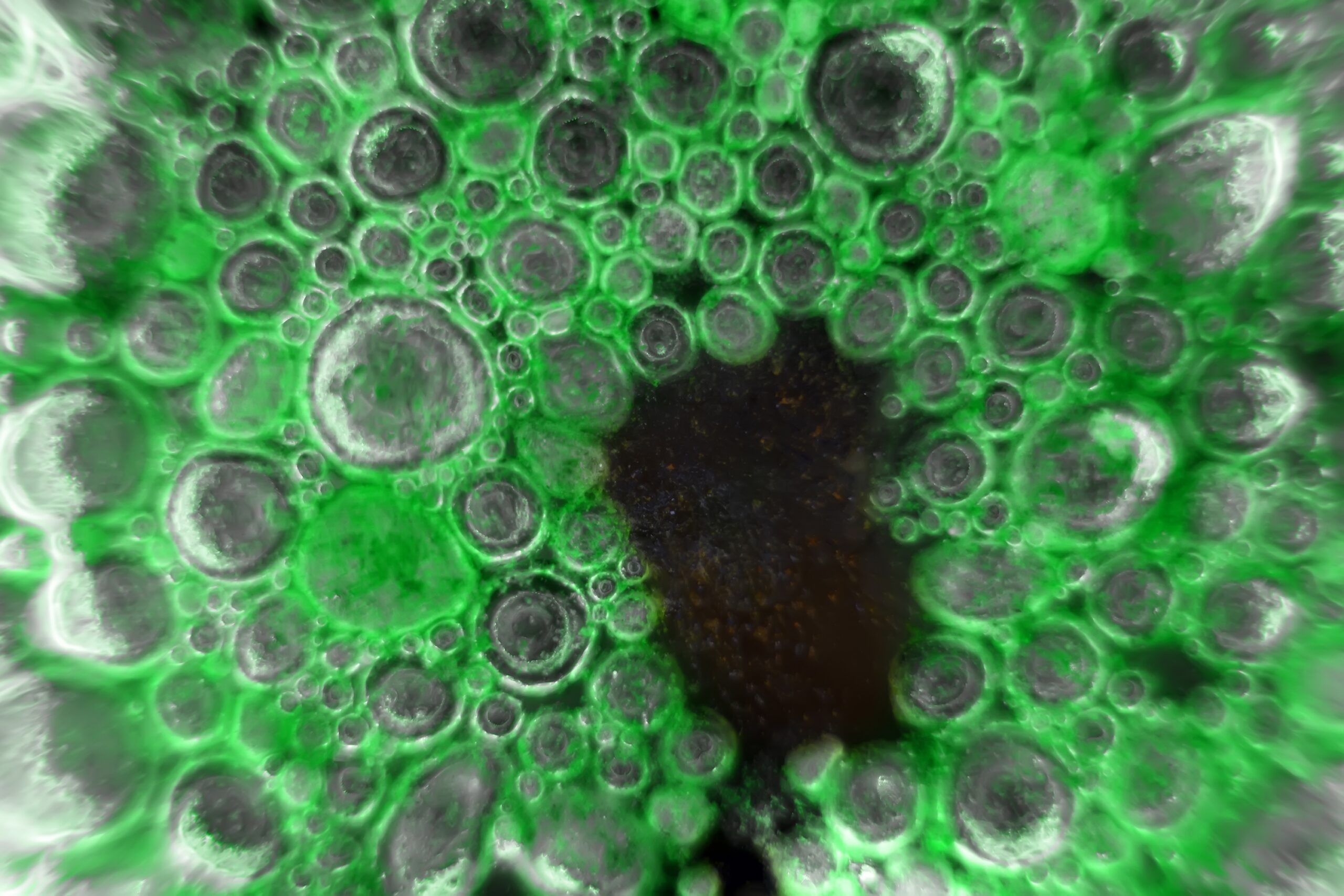 It looks like a colony of bacteria under a microscope (cyanobacterial community). The first unicellular organisms at the dawn of life also looked like. Fantasy on the theme of the origin of life.