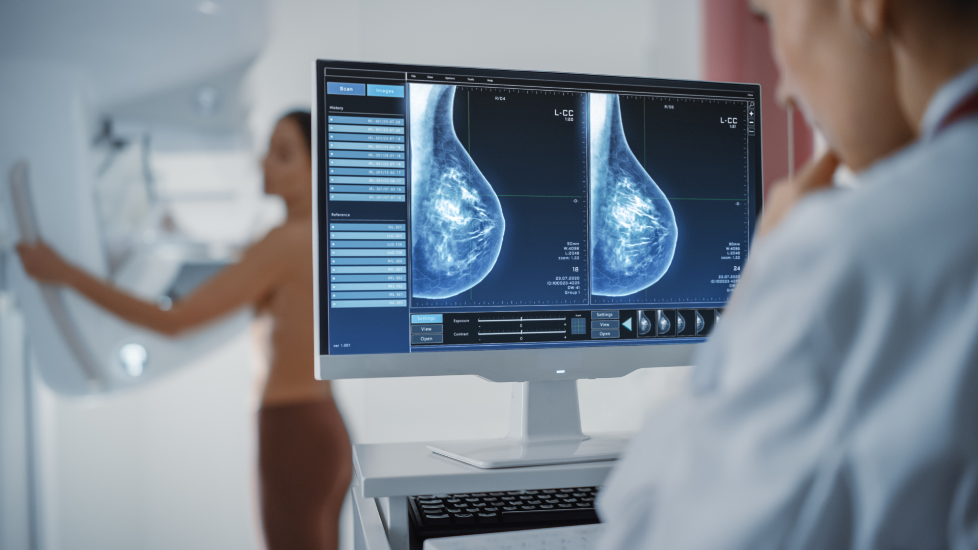 A computer monitor displaying digital mammogram scans, with a doctor reviewing the screen and a patient standing at the imaging machine in the blurred background.