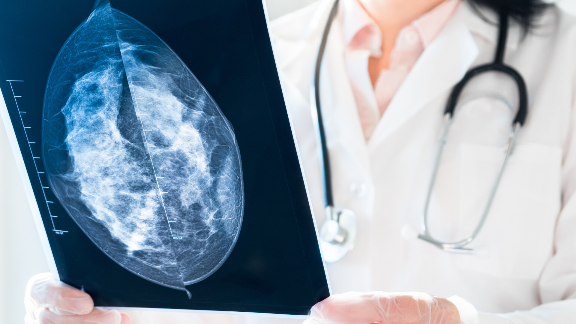 A close-up of a doctor wearing a white coat and stethoscope holding up and examining a mammogram X-ray film.