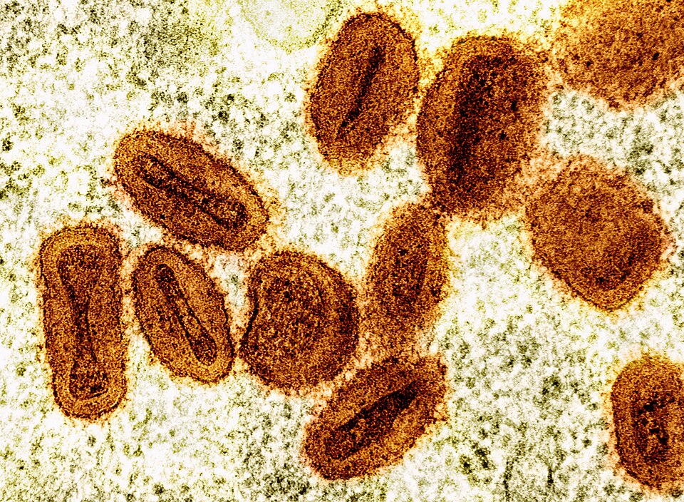 Electron microscope image of mpox virus particles viewed at high magnification.