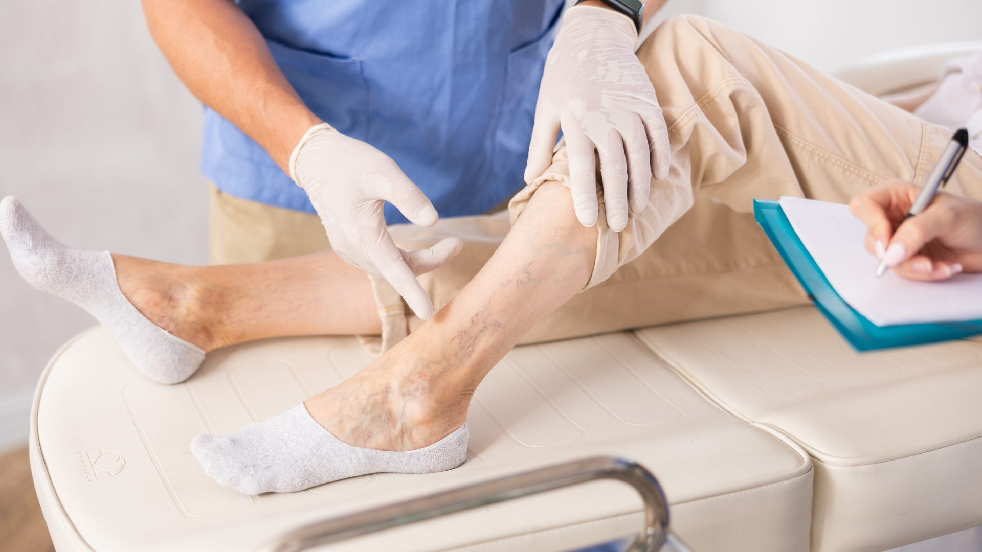 A healthcare worker in gloves pointing to visible varicose veins on a patient's leg during a medical evaluation.