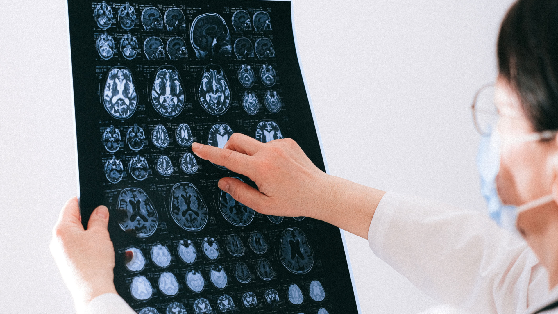 A medical professional wearing a face mask holds up a detailed brain MRI scan sheet, pointing directly to one of the brain cross-section images.